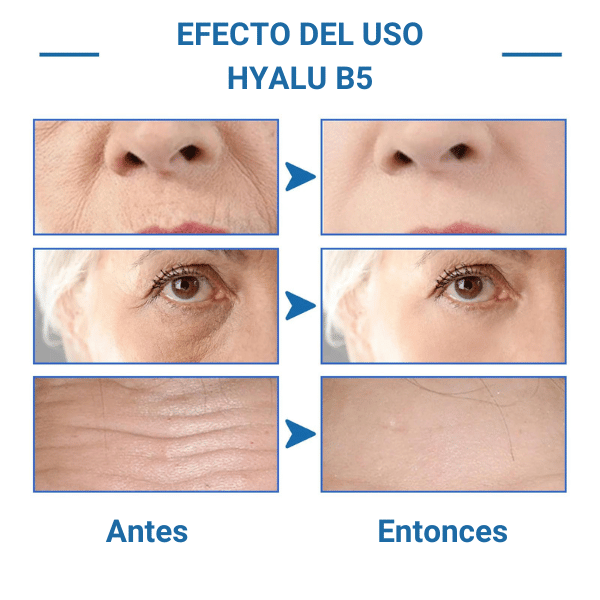 Corrector de Piel Hyalu B5, Reduce Manchas y Unifica el Tono